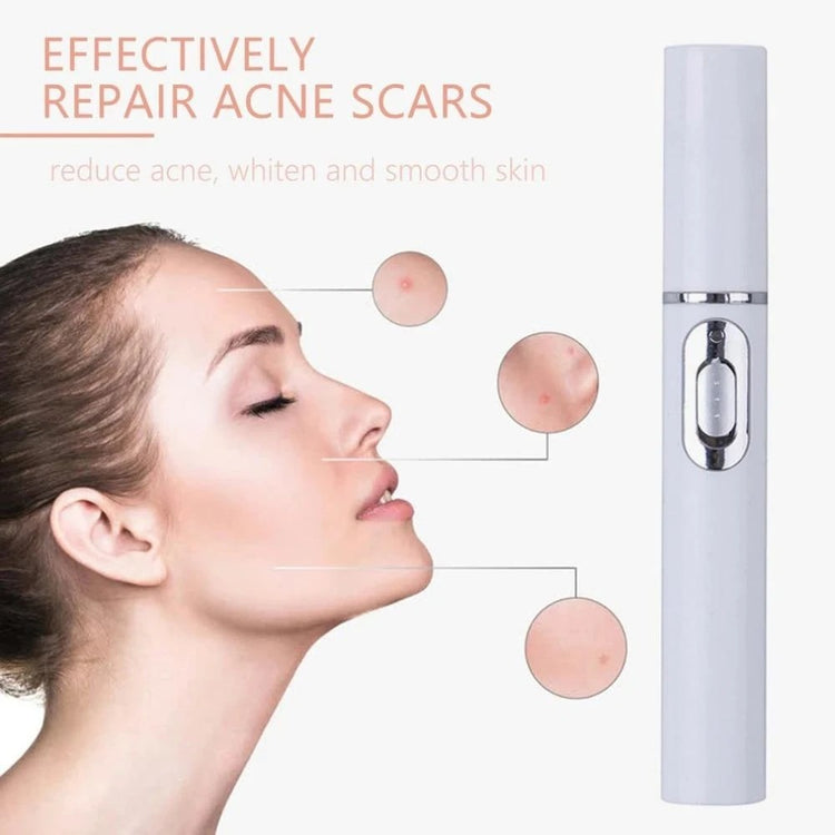 Blue Light Therapy Acne Laser Pen Soft Scar Wrinkle Removal Treatment Device Skin Care Beauty Equipment-0-Rambla Store