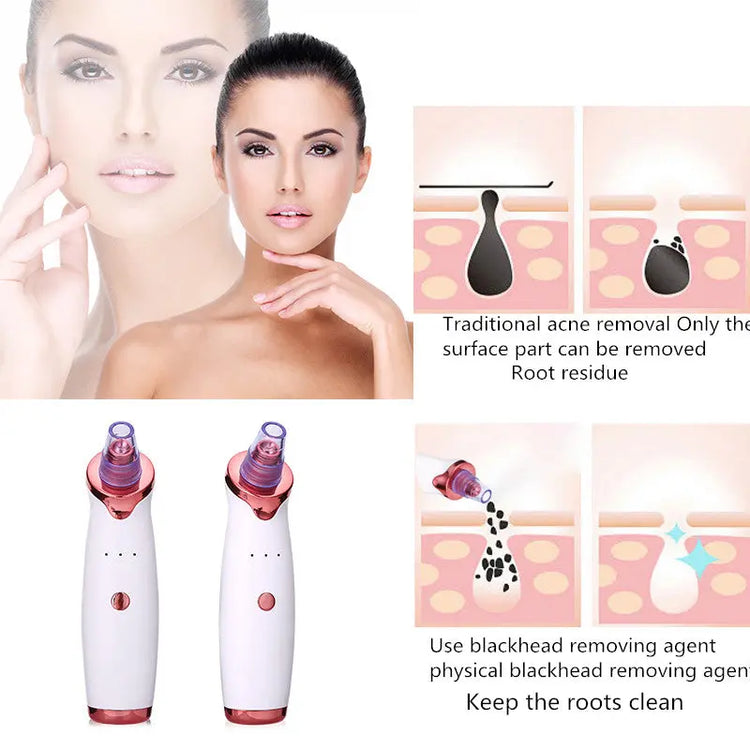 Blackhead Remover Instrument Black Dot Remover Acne Vacuum Suction Face Clean Black Head Pore Cleaning Beauty Skin Care Tool-5-Rambla Store