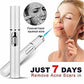 Blue Light Therapy Acne Laser Pen Soft Scar Wrinkle Removal Treatment Device Skin Care Beauty Equipment-0-Rambla Store