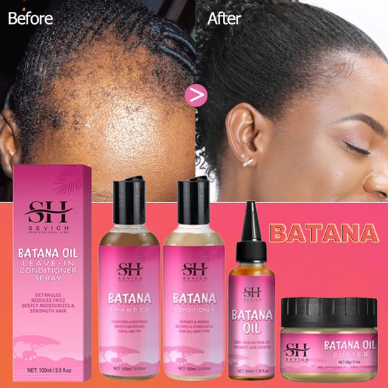 Regrow Hair Naturally: Batana Hair Growth Oil & Anti-Hair Loss Set for Men & Women