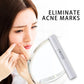 Blue Light Therapy Acne Laser Pen Soft Scar Wrinkle Removal Treatment Device Skin Care Beauty Equipment-0-Rambla Store