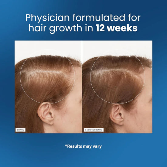 Be Bodywise Hair Growth Serum Roll-On 25ml ( Pack of 3 )