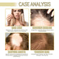 Nourishing Hair Care Oil - Rosemary & Lavender Essential Oil for Dense Hair Men and Women
